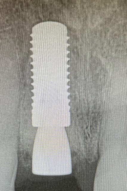 Cny Periodontics and Implants photo 6
