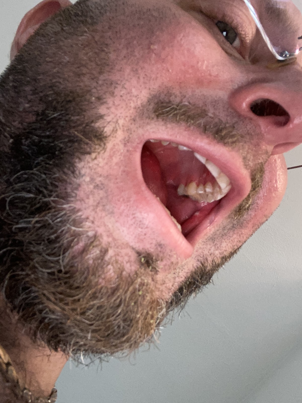 Aspen Dental - Stuart photo 4