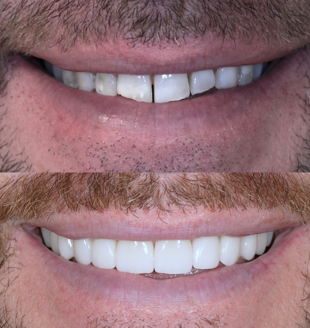 Premier Smiles & Implant Dentistry photo 2