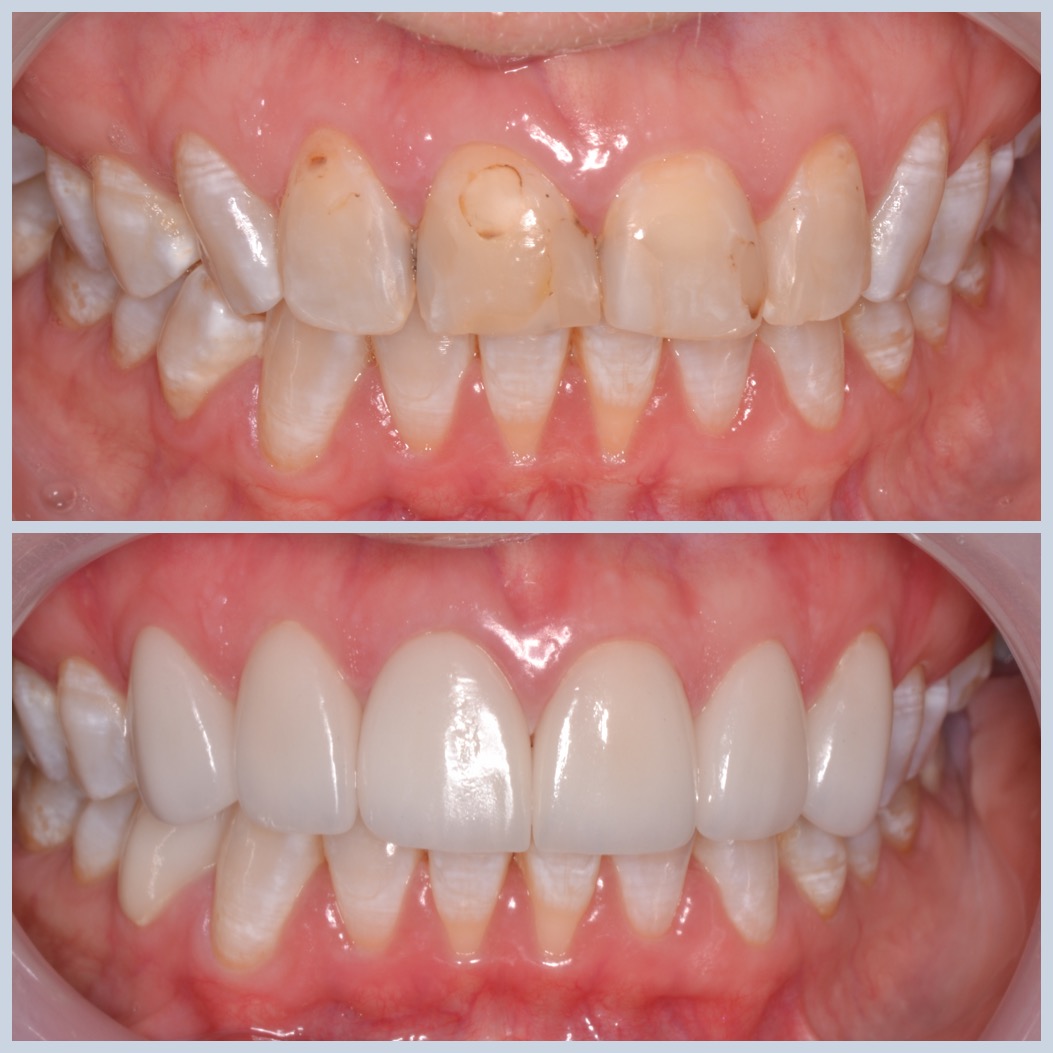 Smiles for Life Dental Care photo 2