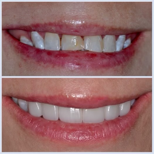 Smiles for Life Dental Care photo 5