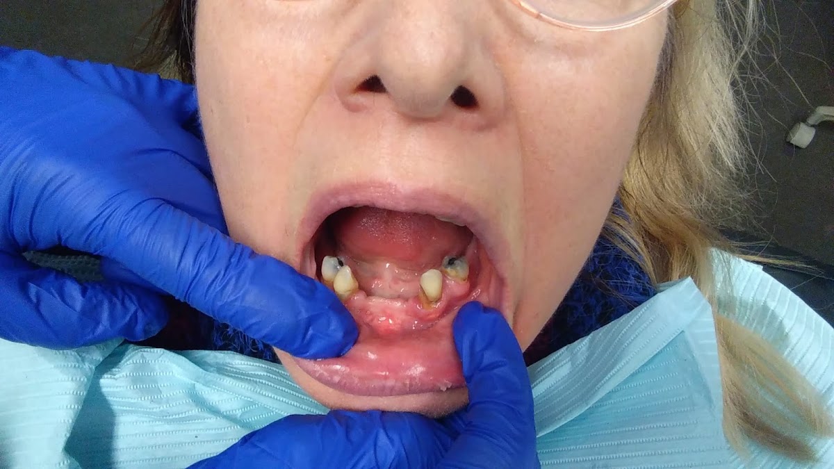 Advantage Dental+ photo 1