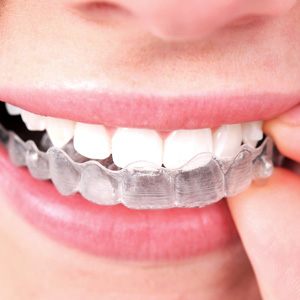 Dr. Tim Rauch, DDS photo 4