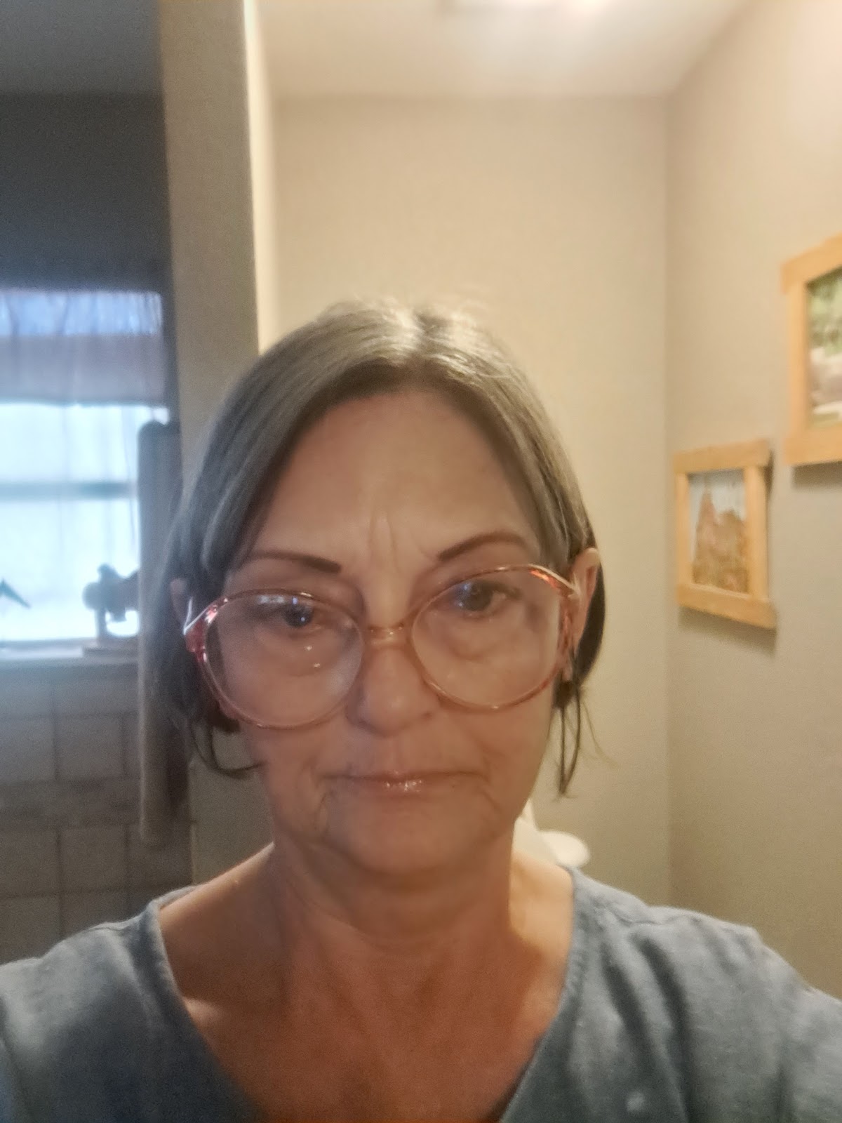 Abilene Surgical Associates - Oral And Maxillofacial Surgery photo 5