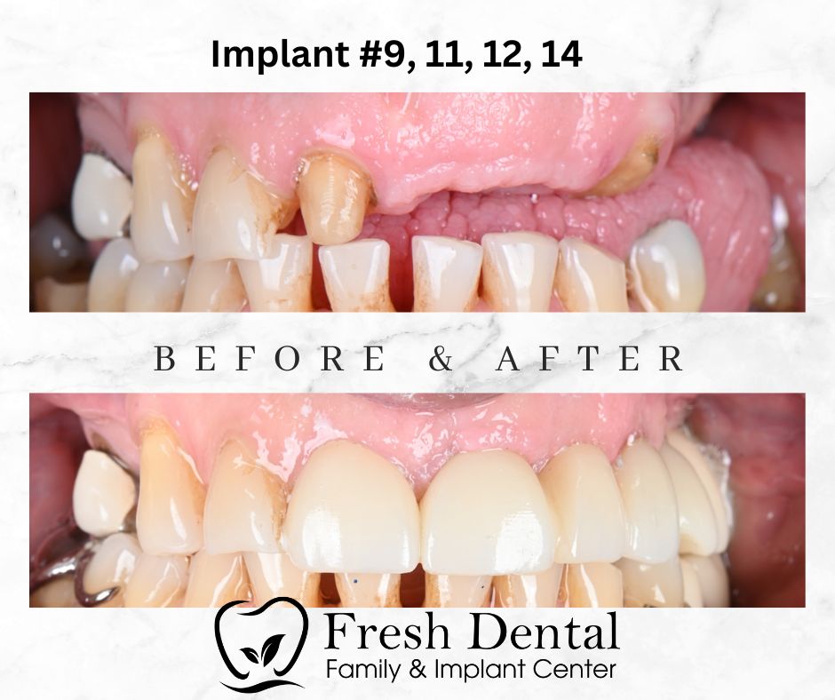 Fresh Dental Orthodontics & Implant Center photo 3