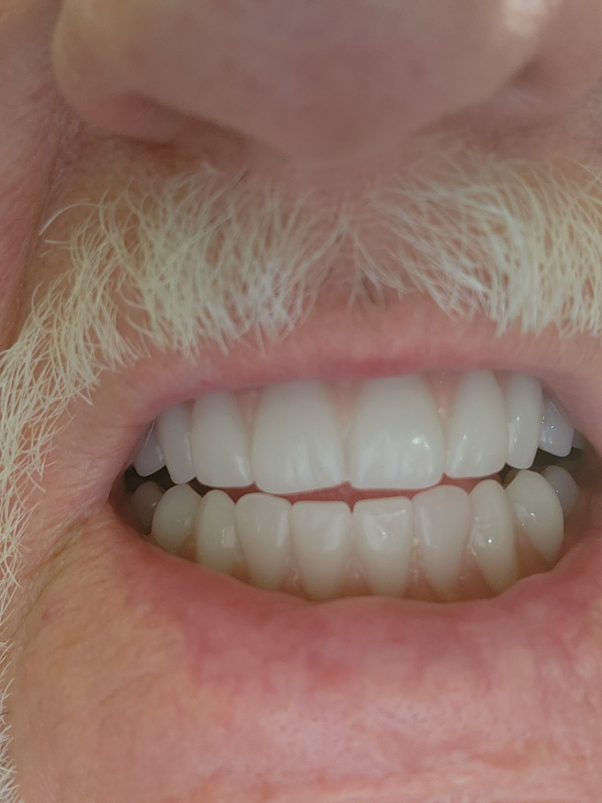 Aspen Dental - Gastonia photo 3