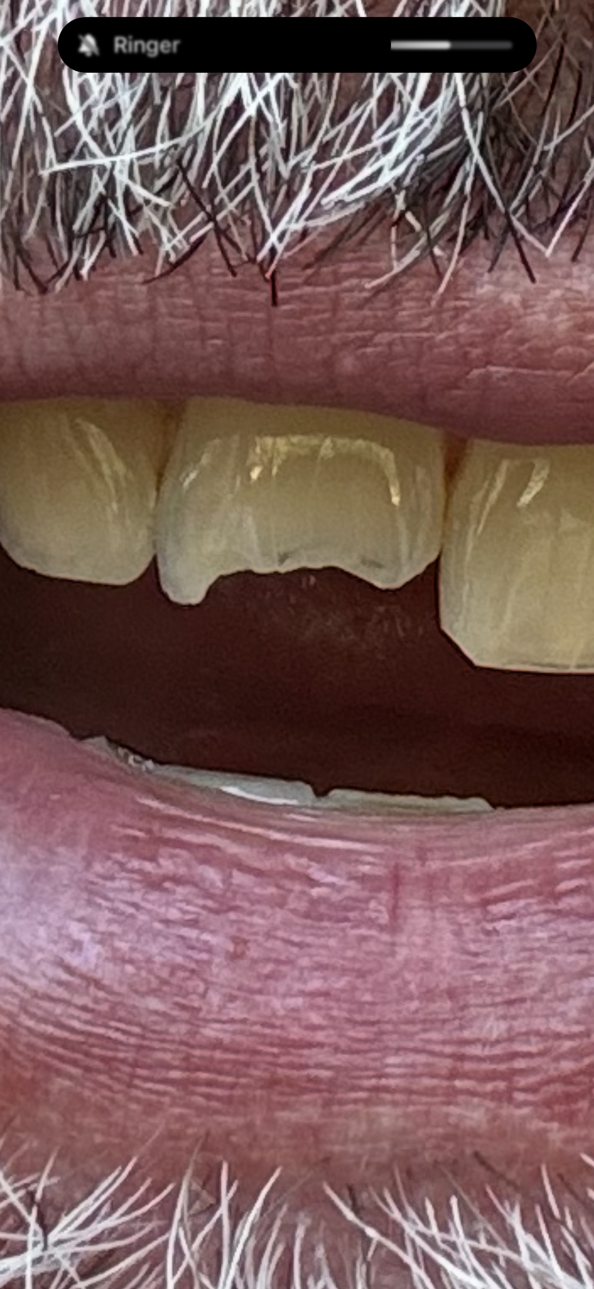 Aspen Dental - Cedar Park photo 1
