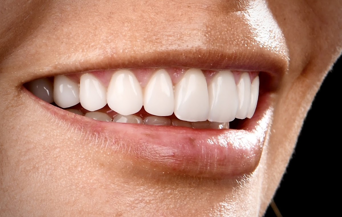Dental Illusions photo 2