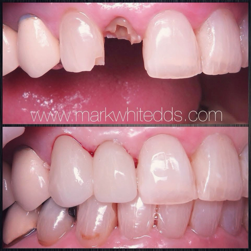 Dr. Mark White-valley Dental Associates photo 1