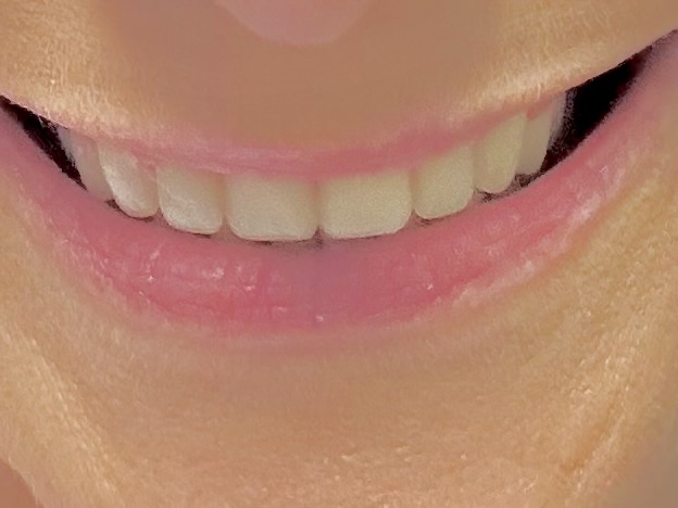 Redhawk Dental Care photo 3