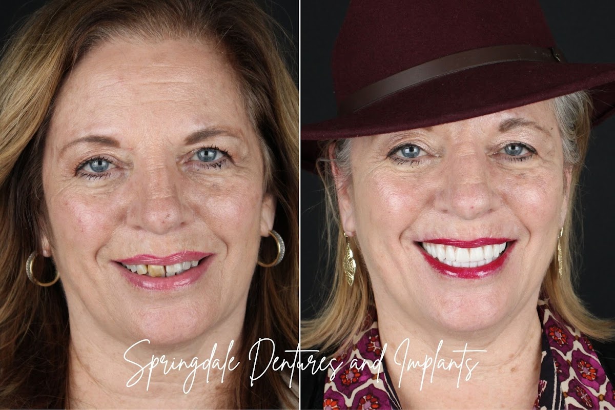 Springdale Dentures and Implants photo 1