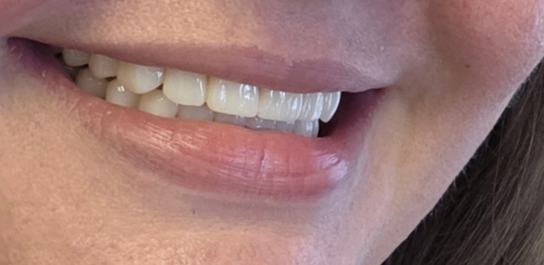 Springdale Dentures and Implants photo 6