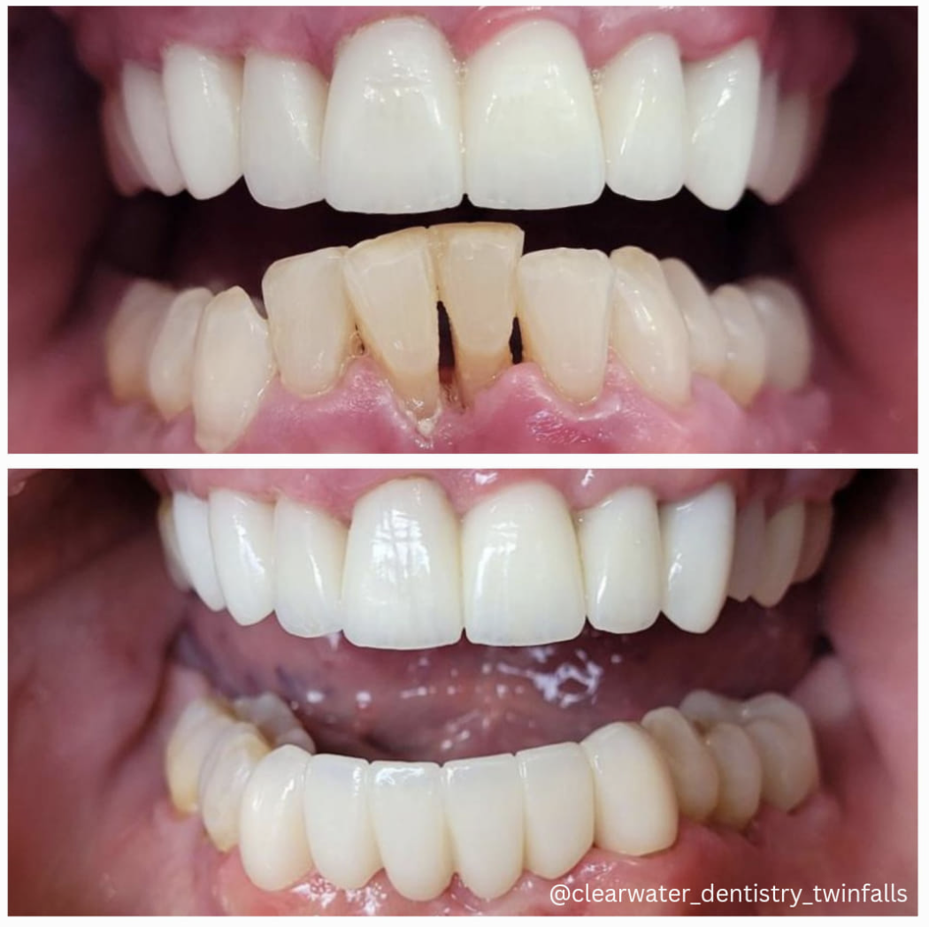 Clearwater Dentistry photo 6