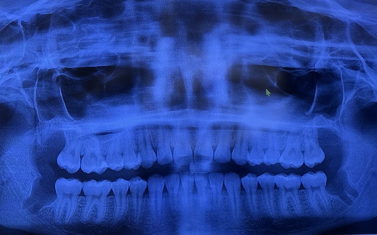 Peak Oms and Dental Implant Center photo 2