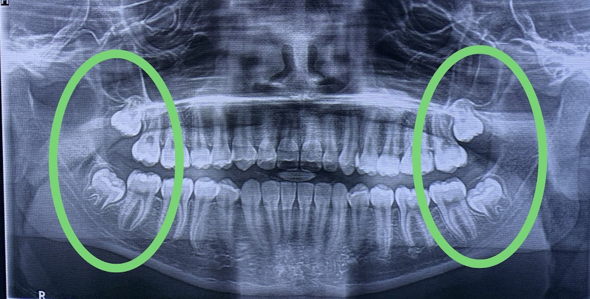 Dr. Johanny Caceres. Oral & Facial Surgery of Miami photo 1