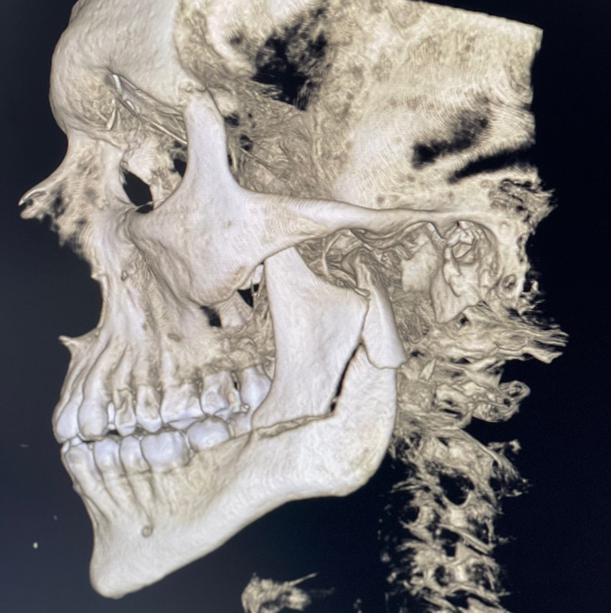 Dr. Johanny Caceres. Oral & Facial Surgery of Miami photo 2