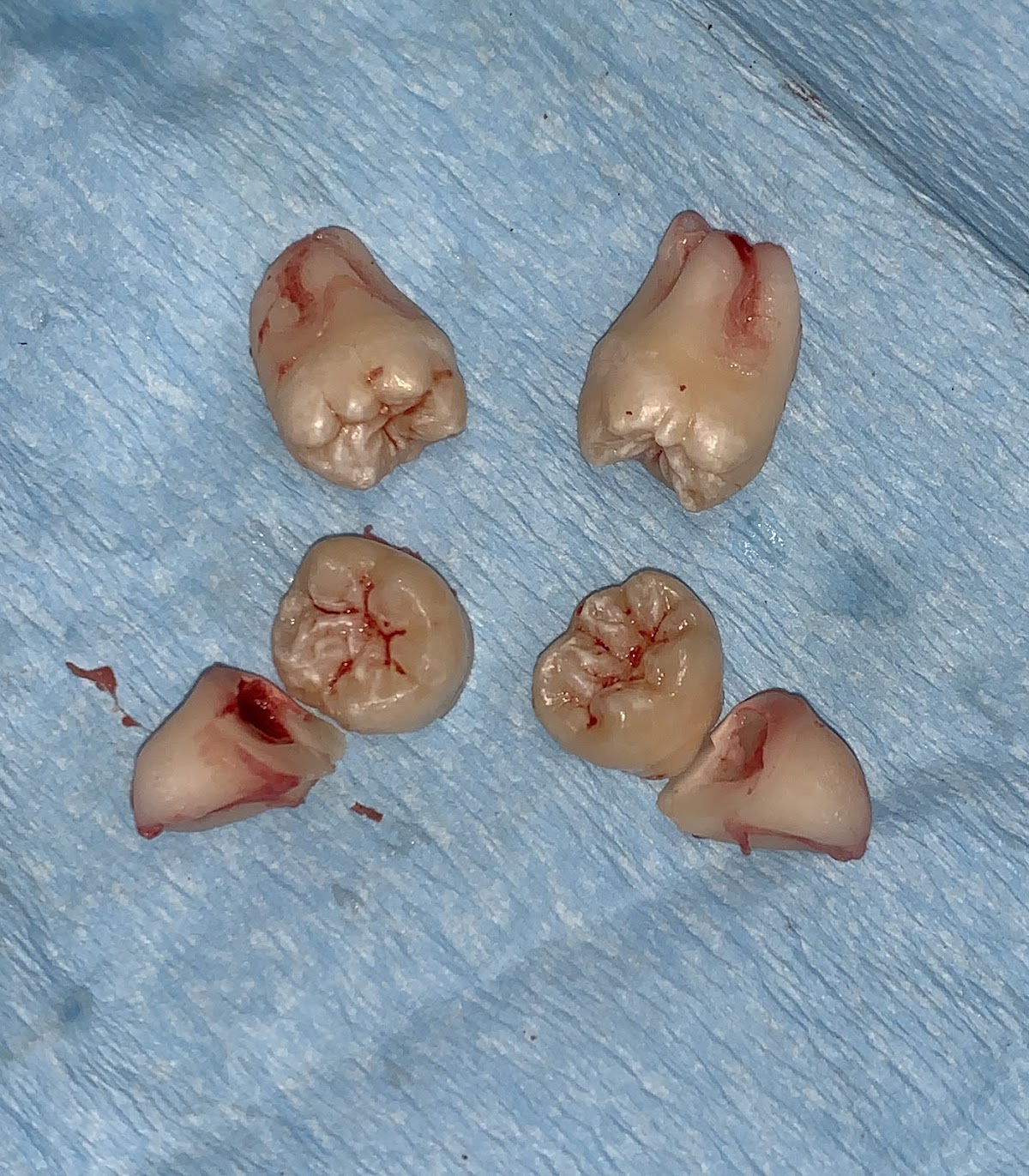 Dr. Johanny Caceres. Oral & Facial Surgery of Miami photo 5