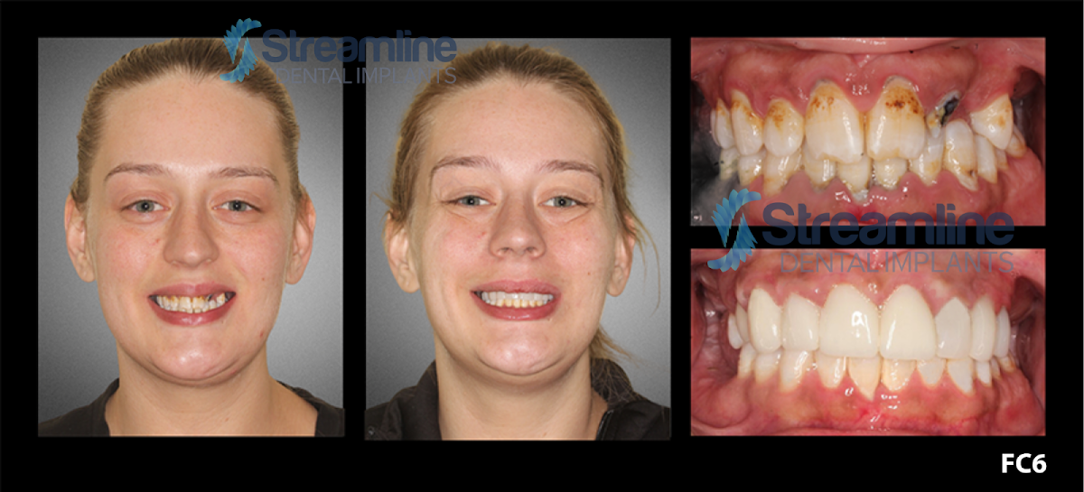 Bird Rock Dental photo 5