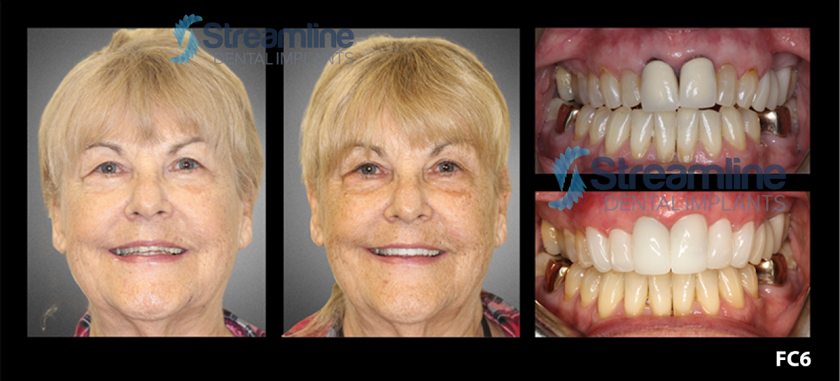 Bird Rock Dental photo 6