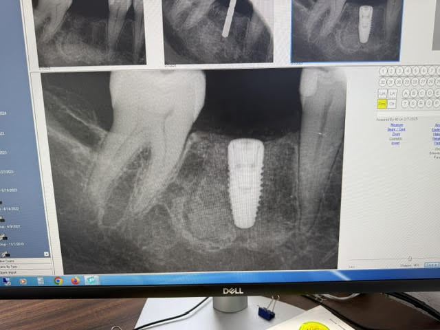 Dental Implants Of Palmdale photo 2