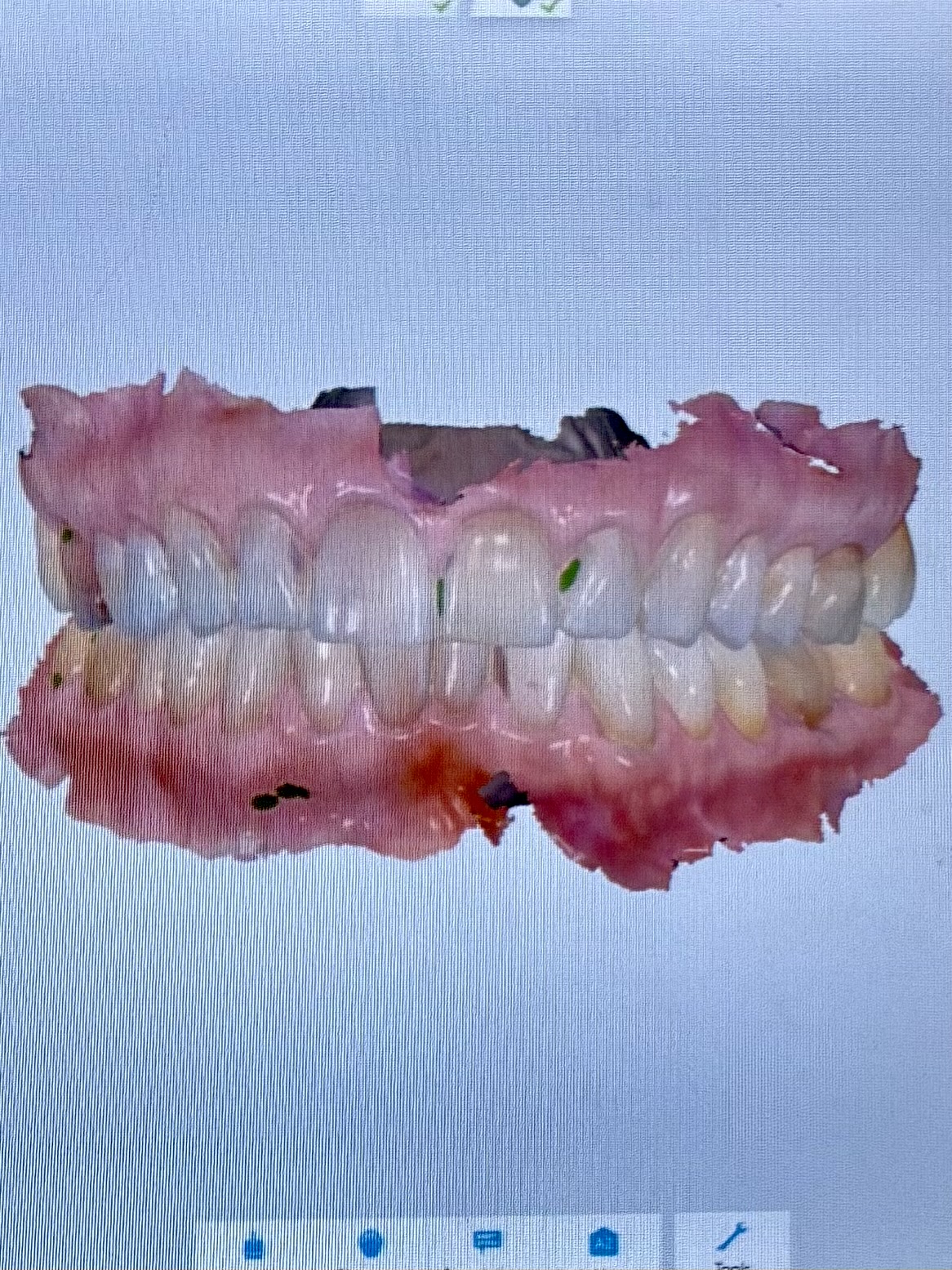 Aspen Dental - Forest Lake photo 4