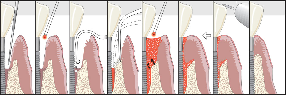 Periodontics and Dental Implants of North Carolina photo 2