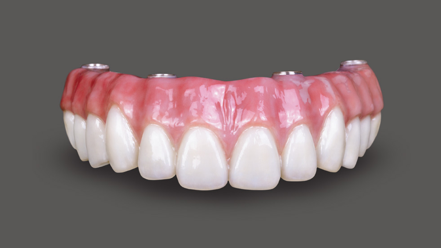 Periodontics and Dental Implants of North Carolina photo 5