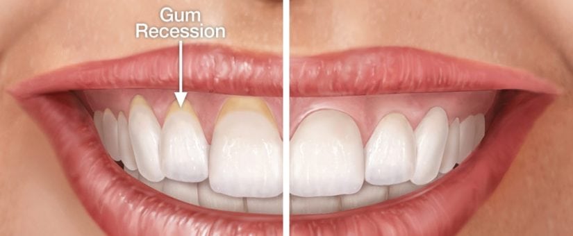 Periodontics and Dental Implants of North Carolina photo 6