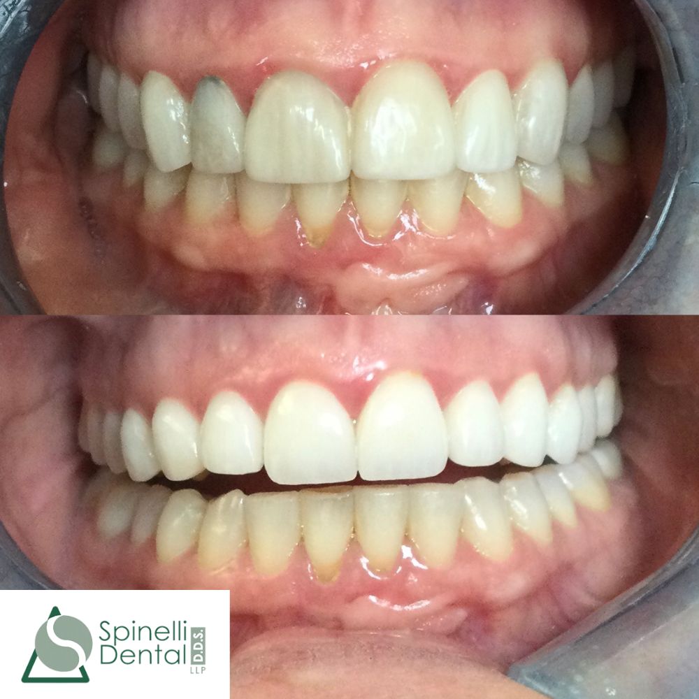 Spinelli Dental photo 4