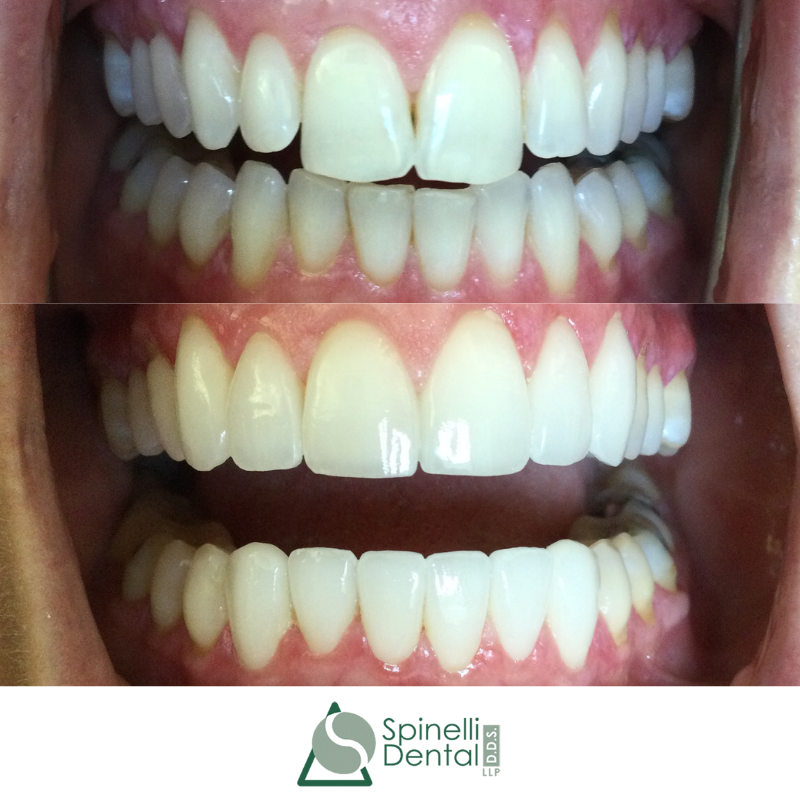 Spinelli Dental photo 5