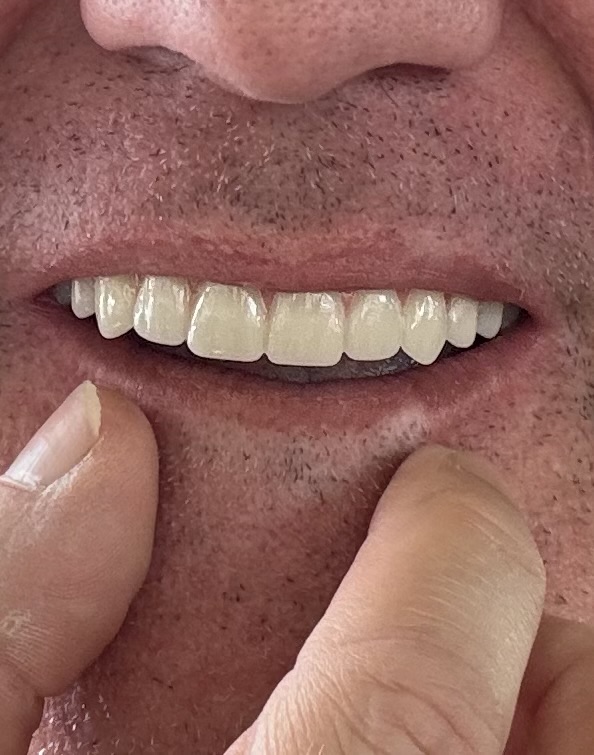 Clearchoice Dental Implant Center - Edina photo 2