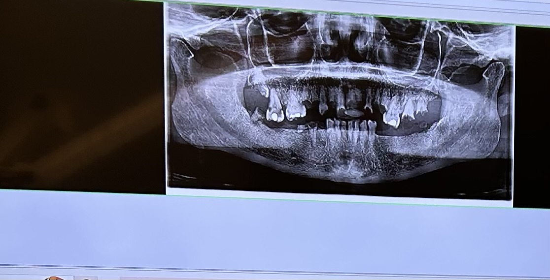 Dental Village Associates of Poughkeepsie photo 3