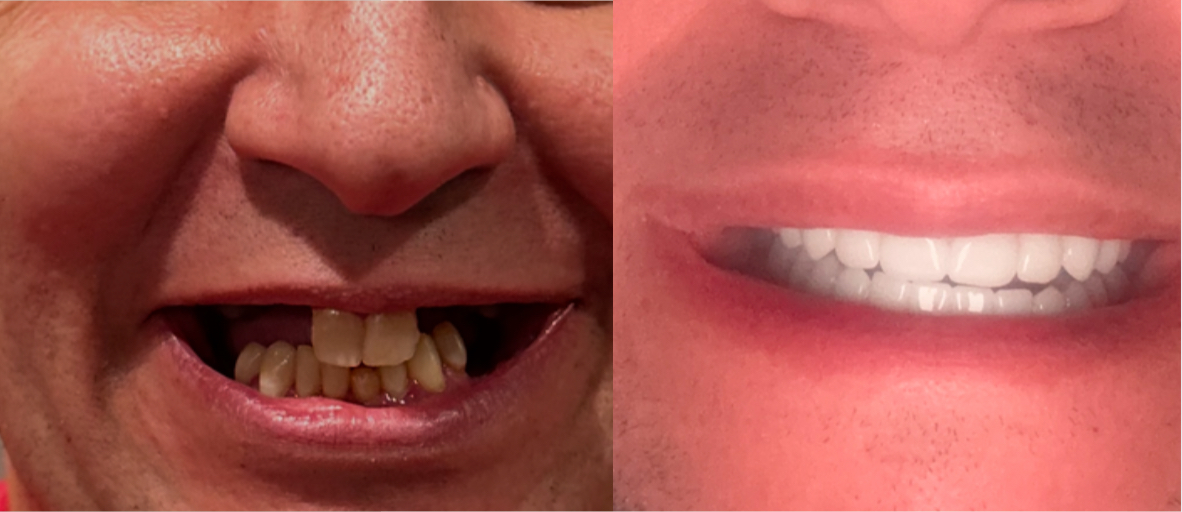 Clearchoice Dental Implant Center - Alpharetta photo 3