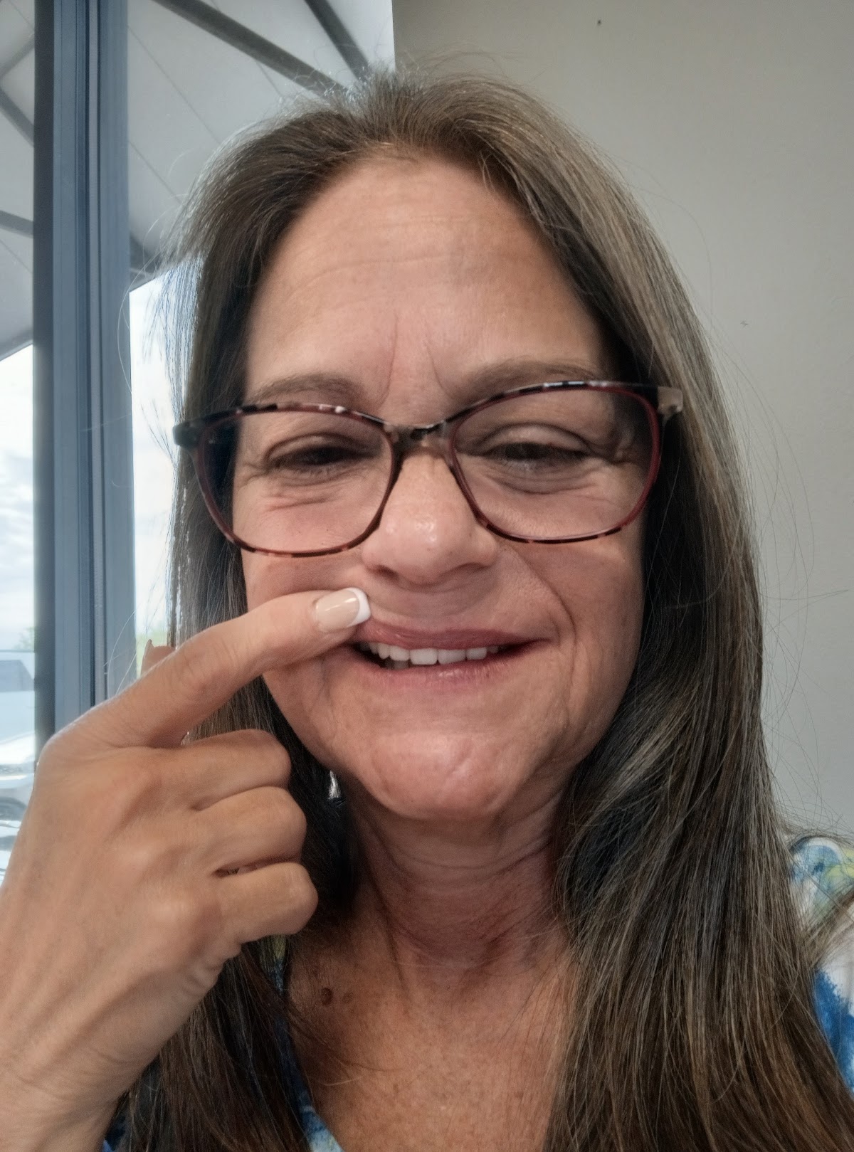 Affordable Dentures & Implants - Lake Charles photo 5