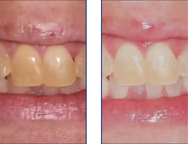 Preference Dental (mecosta) photo 2