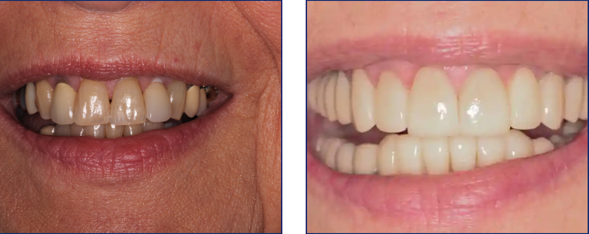 Preference Dental (mecosta) photo 5