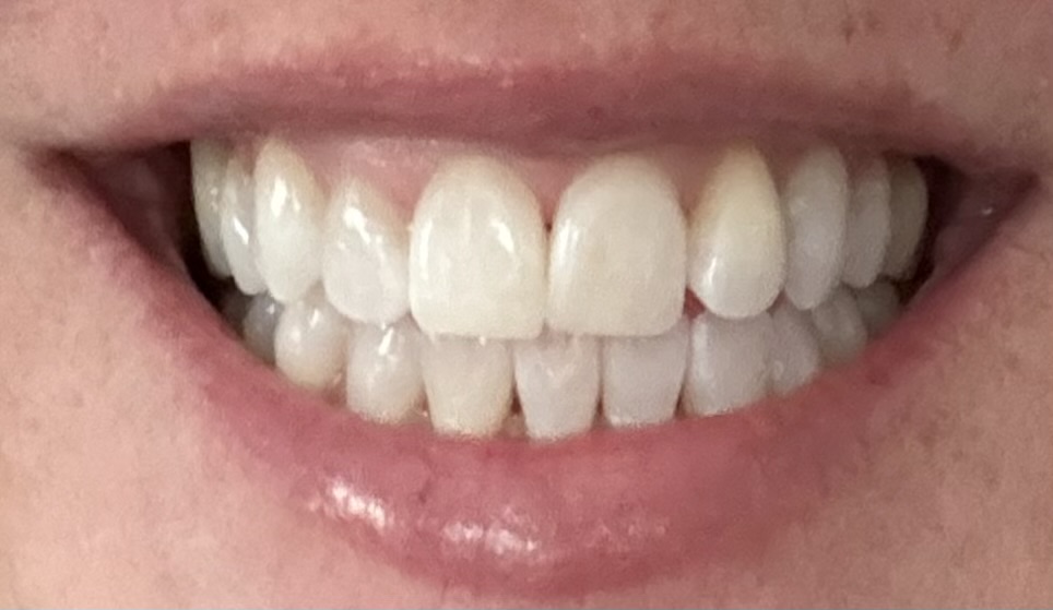 Advanced Dental photo 5