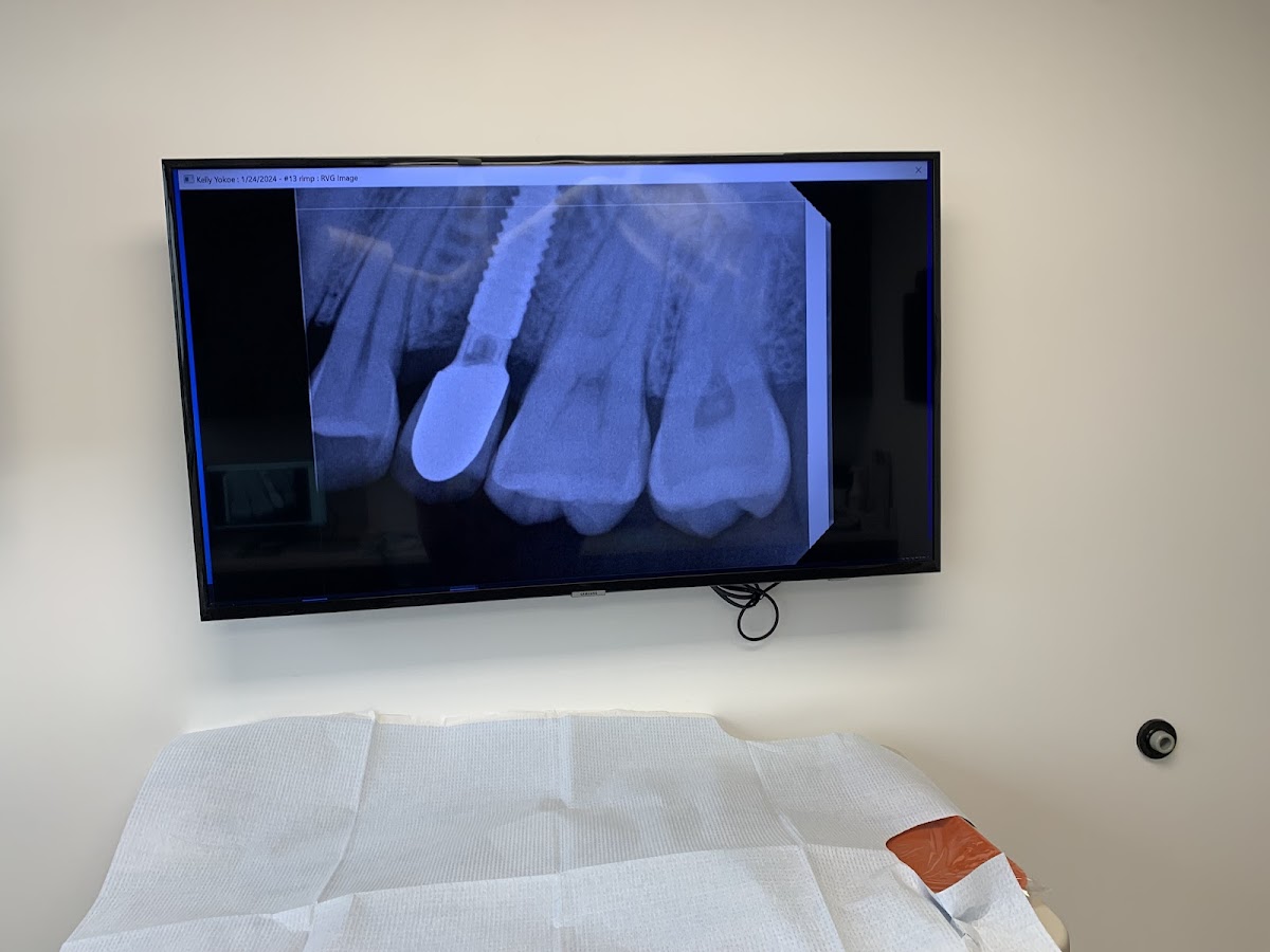 California Oral Surgery & Dental Implant Center photo 4