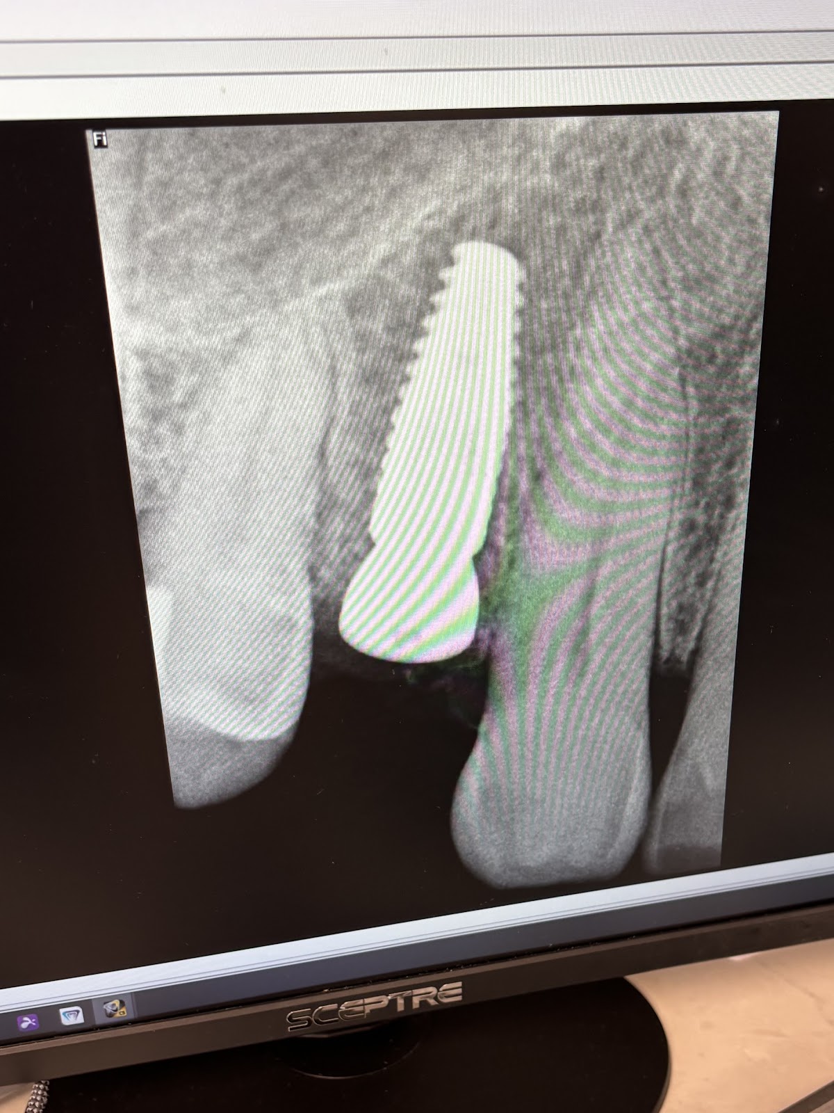 California Oral Surgery & Dental Implant Center photo 5