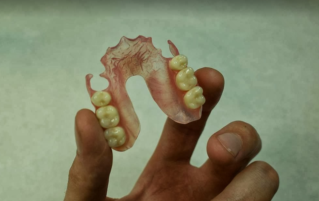 European Denture Center: Caldwell Dentures & Implants photo 4