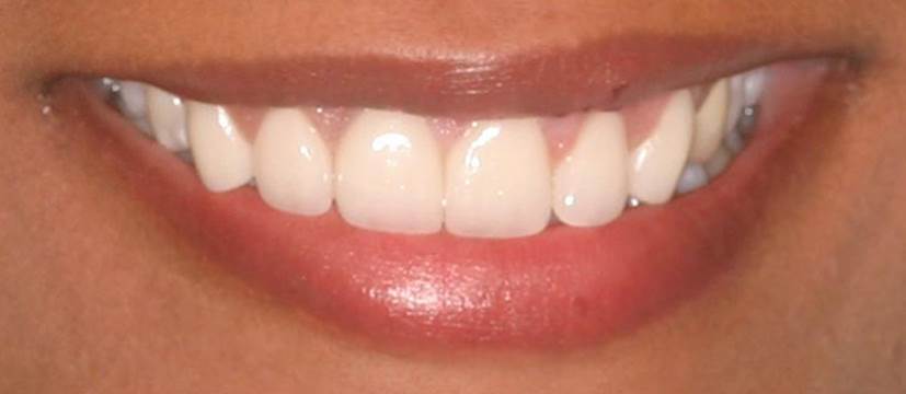 King Dental Arts Inc photo 5