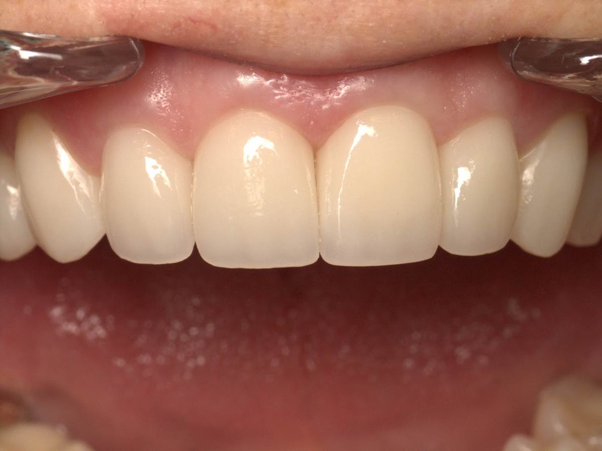 King Dental Arts Inc photo 6