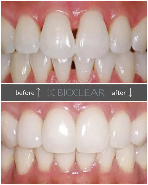 Eversmile Dental photo 4
