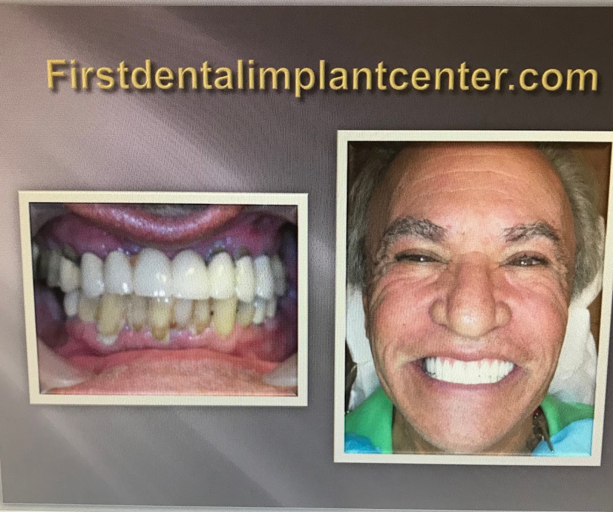 First Dental Implant Center-a Warner Center Advanced Cosmetic Dental Center. photo 2