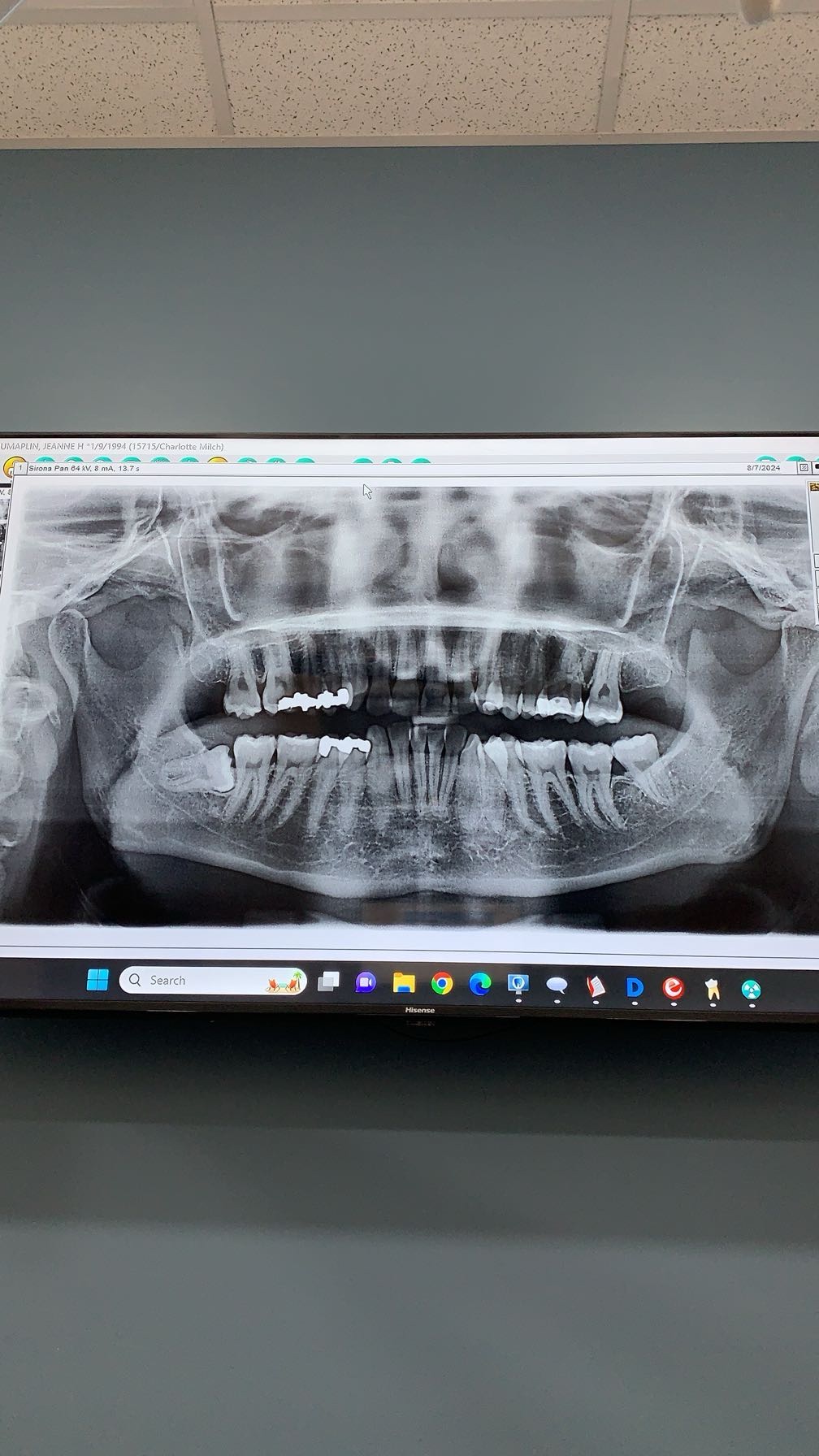 Brightwood Dental - Charlotte Milch, DDS photo 6