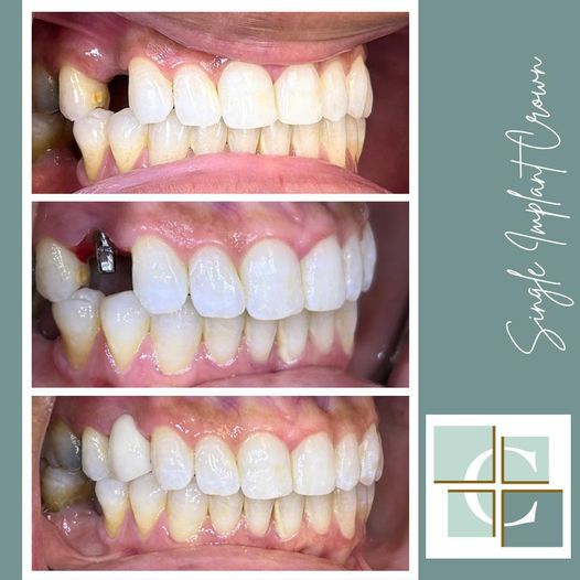 Cornerstone Dentistry photo 3
