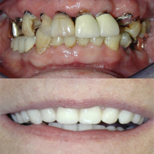 Paul Binon DDS, Msd, Fao and Associates photo 4