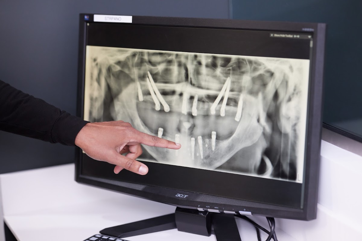 Archone Full Arch Implants photo 3