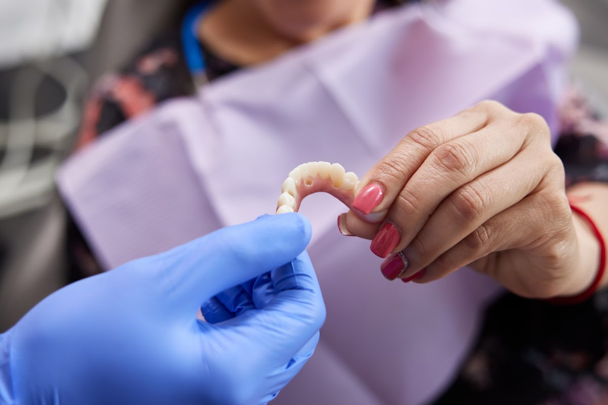 Archone Full Arch Implants photo 6