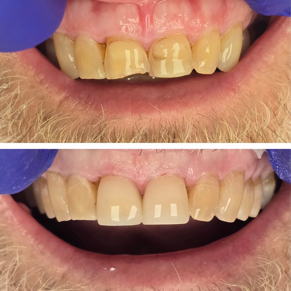 Elm Ridge Implant and Family Dentistry photo 3